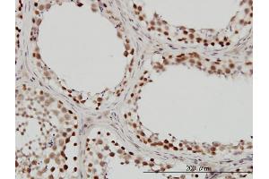 Immunoperoxidase of monoclonal antibody to SMARCB1 on formalin-fixed paraffin-embedded human testis. (SMARCB1 antibody  (AA 81-180))