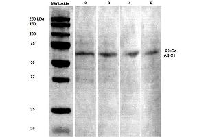 Western Blot analysis of Rat brain lysates showing detection of ASIC1 protein using Mouse Anti-ASIC1 Monoclonal Antibody, Clone S271-44 .