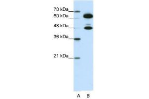 SNRP70 antibody used at 0. (SNRNP70 antibody)