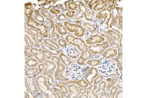 Immunohistochemistry (IHC) image for anti-Complement Component 1, Q Subcomponent Binding Protein (C1QBP) antibody (ABIN7266473)