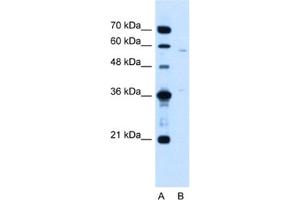 Western Blotting (WB) image for anti-MGC39633 antibody (ABIN2463995) (MGC39633 antibody)