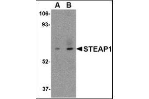 Western blot analysis of STEAP1 in human spleen tissue lysate with this product at (A) 1 and (B) 2 μg/ml.