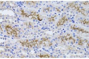 Immunohistochemistry of paraffin-embedded Rat kidney using GGT1 Polyclonal Antibody at dilution of 1:100 (40x lens). (GGT1 antibody)
