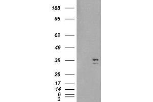 Western Blotting (WB) image for Sirtuin 4 (SIRT4) peptide (ABIN370464) (Sirtuin 4 (SIRT4) Peptide)