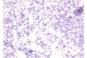 Immunohistochemistry of paraffin-embedded human spleen tissue using ABIN7173868 at dilution of 1:100 (RELT antibody  (AA 26-153))