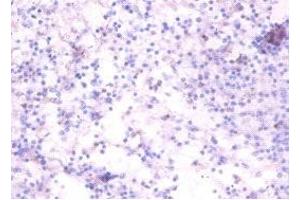 Immunohistochemistry of paraffin-embedded human spleen tissue using ABIN7173868 at dilution of 1:100 (RELT antibody  (AA 26-153))