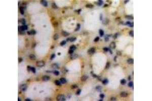IHC-P analysis of Kidney tissue, with DAB staining. (COL6A1 antibody  (AA 828-1022))