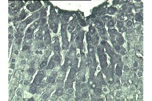 Poly(ADP-ribose) staining of rat liver. (pADPR antibody)