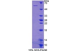 SDS-PAGE analysis of Human Integrin beta 1 Protein.