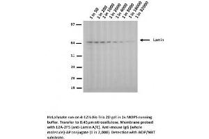 Image no. 1 for anti-Lamin A/C (LMNA) (Arg453Trp-Mutant) antibody (ABIN1042618) (Lamin A/C antibody  (Arg453Trp-Mutant))