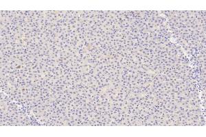 Detection of ANGPT1 in Human Liver Tissue using Polyclonal Antibody to Angiopoietin 1 (ANGPT1) (Angiopoietin 1 antibody  (AA 284-452))
