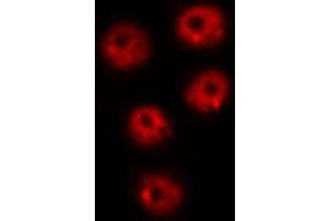 ABIN6267639 staining COS7 by IF/ICC. (PIN1 antibody  (pSer16))