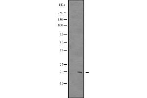 Western blot analysis of CIRBP expression in HCT116 whole cell lysate ,The lane on the left is treated with the antigen-specific peptide.