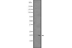 Western blot analysis of CIRBP expression in HCT116 whole cell lysate ,The lane on the left is treated with the antigen-specific peptide. (CIRBP antibody  (C-Term))