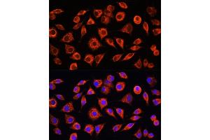 Immunofluorescence (IF) image for anti-C-Reactive Protein (CRP) (AA 1-224) antibody (ABIN3020716)