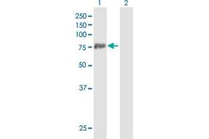 PADI3 antibody  (AA 1-664)