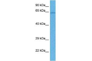 Host:  Rabbit  Target Name:  FZD4  Sample Tissue:  Human Lung Tumor  Antibody Dilution:  1ug/ml (FZD4 antibody  (Middle Region))