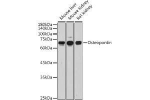 Western blot analysis of extracts of various cell lines, using Osteopontin antibody (ABIN3021921, ABIN3021922, ABIN3021923 and ABIN6217674) at 1:1000 dilution. (Osteopontin antibody  (AA 17-314))