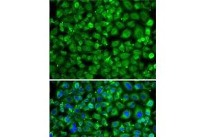 Immunofluorescence analysis of A-549 cells using SAT2 Polyclonal Antibody (SAT2 antibody)