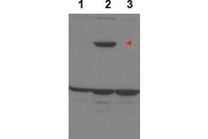 Image no. 1 for anti-Protein Phosphatase 1, Regulatory Subunit 13B (PPP1R13B) (Internal Region) antibody (ABIN401394) (PPP1R13B antibody  (Internal Region))
