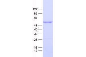 DP2 Protein (His tag)