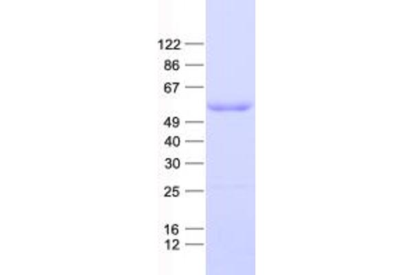 DP2 Protein (His tag)