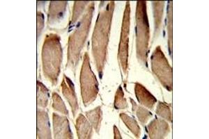 Formalin-fixed and paraffin-embedded human skeletal muscle reacted with RRM2 Antibody (Center), which was peroxidase-conjugated to the secondary antibody, followed by DAB staining. (RRM2 antibody  (AA 96-125))