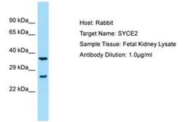 SYCE2 antibody  (AA 146-195)