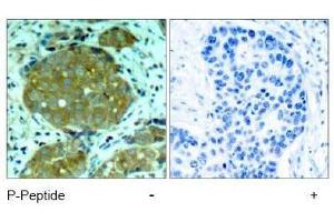 Image no. 1 for anti-Nuclear Factor of kappa Light Polypeptide Gene Enhancer in B-Cells 1 (NFKB1) (pSer932) antibody (ABIN197008) (NFKB1 antibody  (pSer932))