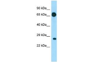 WB Suggested Anti-EIF4E1B Antibody Titration: 1. (EIF4E1B antibody  (N-Term))