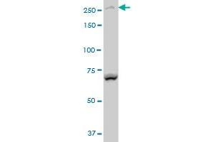 BCOR polyclonal antibody (A01), Lot # 051214JC01 Western Blot analysis of BCOR expression in Y-79 (ABIN1339626). (BCOR antibody  (AA 1361-1460))