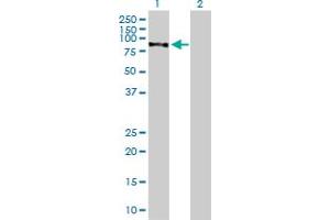 Western Blotting (WB) image for anti-Choroideremia-Like (Rab Escort Protein 2) (CHML) (AA 1-656) antibody (ABIN514395)