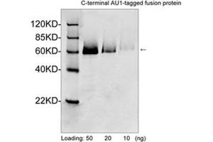 Western blot analysis of AU1 tagged fusion proteins expressed in E.