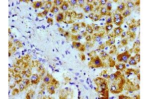 Immunohistochemistry of paraffin-embedded human liver tissue using ABIN7168945 at dilution of 1:100 (AGXT antibody  (AA 112-294))