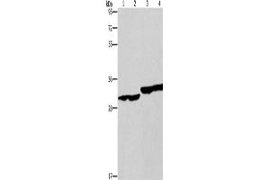 Western Blotting (WB) image for anti-2,4-Dienoyl CoA Reductase 1, Mitochondrial (DECR1) antibody (ABIN2434542)