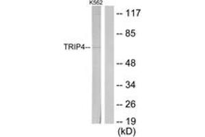 Western blot analysis of extracts from K562 cells, using TRIP4 Antibody. (TRIP4 antibody  (AA 81-130))