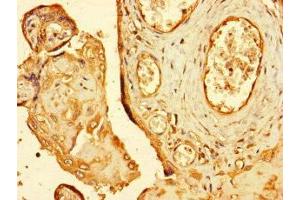 Immunohistochemistry of paraffin-embedded human placenta tissue using ABIN7151194 at dilution of 1:100 (RNF4 antibody  (AA 1-103))