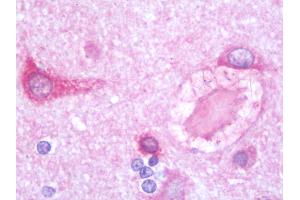 Anti-PSPLA1 / PLA1A antibody IHC staining of human brain, cortex. (PSPLA1 / Phospholipase A1 (C-Term) antibody)