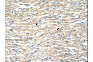 Image no. 1 for anti-LIM Homeobox Transcription Factor 1, alpha (LMX1A) (AA 244-293) antibody (ABIN203096) (LMX1A antibody  (AA 244-293))