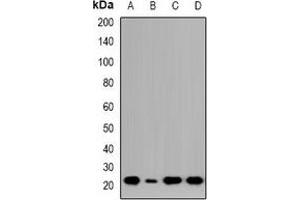 Western blot analysis of NTPCR expression in HCT116 (A), Jurkat (B), COLO205 (C), LO2 (D) whole cell lysates.