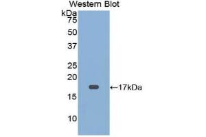 Detection of Recombinant CD59, Mouse using Polyclonal Antibody to Cluster of Differentiation 59 (CD59) (CD59 antibody  (AA 22-96))