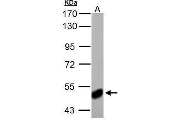 ABAT antibody