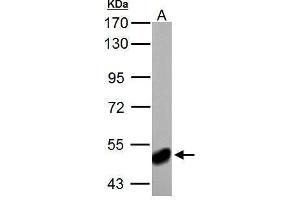 WB Image ABAT antibody detects ABAT protein by Western blot analysis.