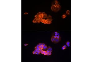 Immunofluorescence analysis of MCF7 cells using MMP13 Rabbit mAb (ABIN7268419) at dilution of 1:100 (40x lens). (MMP13 antibody)