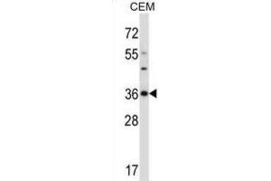 Western Blotting (WB) image for anti-Cyclin-Dependent Kinase 3 (CDK3) antibody (ABIN2997548) (CDK3 antibody)