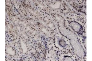 Image no. 1 for anti-PTK6 Protein tyrosine Kinase 6 (PTK6) (AA 342-452) antibody (ABIN599424) (PTK6 antibody  (AA 342-452))