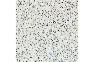 IHC analysis of U1-C/SNRPC using anti-U1-C/SNRPC antibody (ABIN7599016). (SNRPC antibody  (AA 1-159))