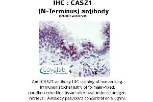 Image no. 1 for anti-Castor Zinc Finger 1 (CASZ1) (N-Term) antibody (ABIN1732691) (CASZ1 antibody  (N-Term))