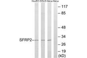 Western blot analysis of extracts from HeLa/COLO/HuvEc cells, using SFRP2 Antibody. (SFRP2 antibody  (AA 119-168))