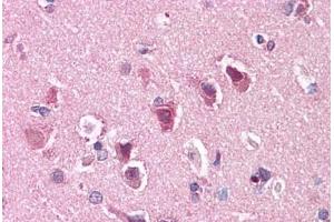 Human Brain, Cortex: Formalin-Fixed, Paraffin-Embedded (FFPE)